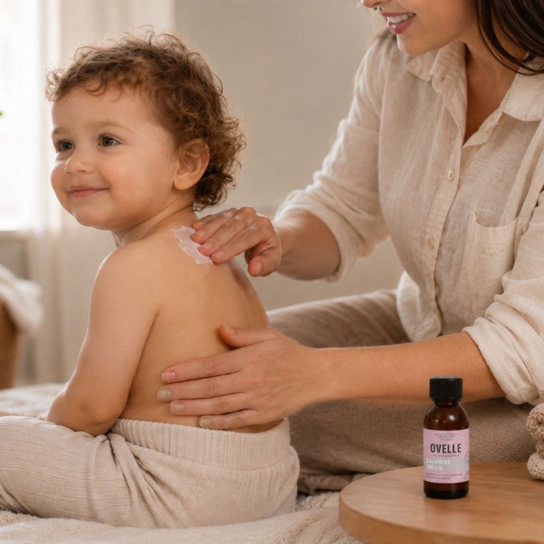 Ovelle Calamine Cream kasutamine tuulerõugete korral sügeleval nahal